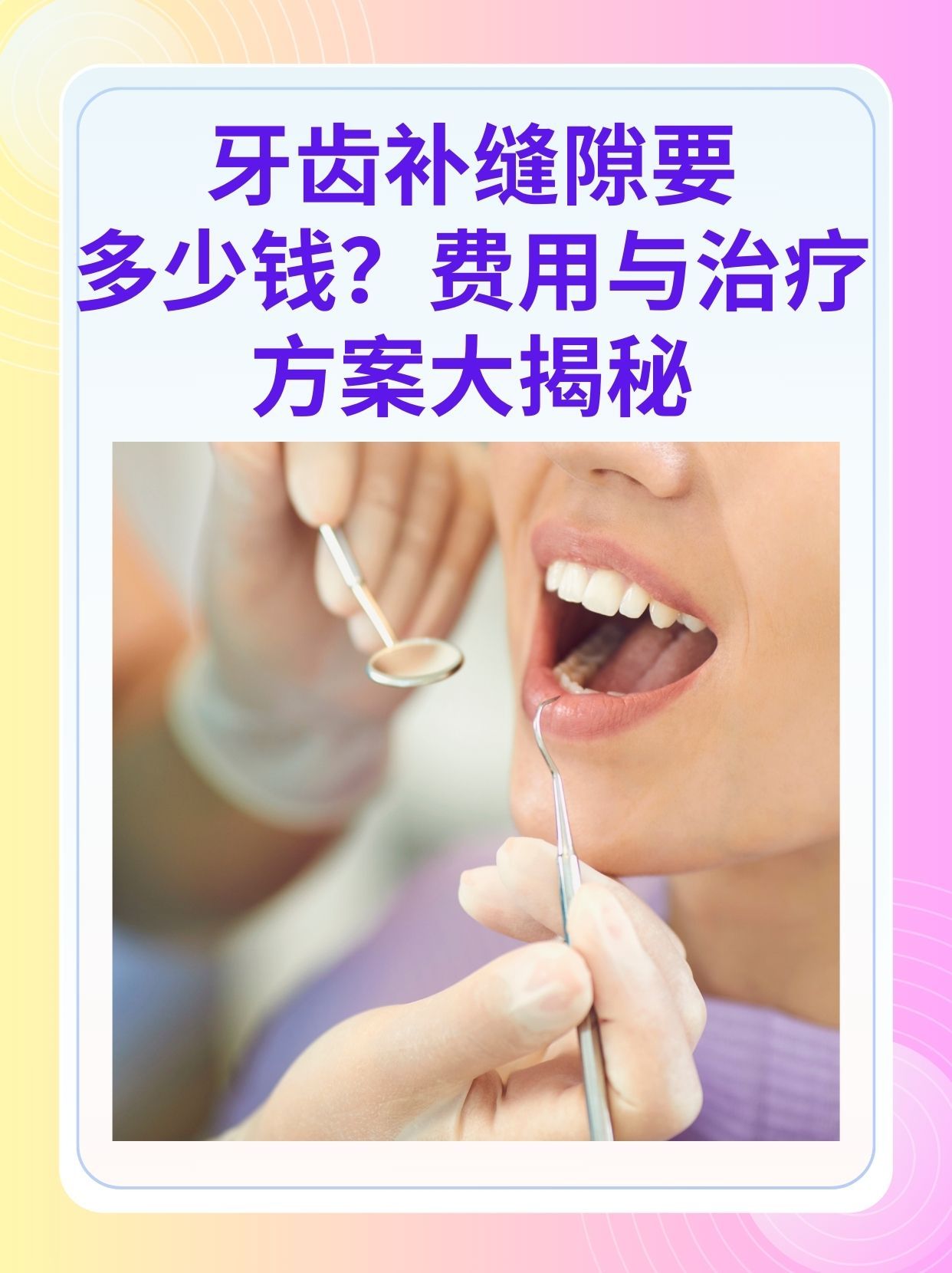 成都补牙医保可以报销吗(补牙医保可以报销吗 哪些可以报销呢)